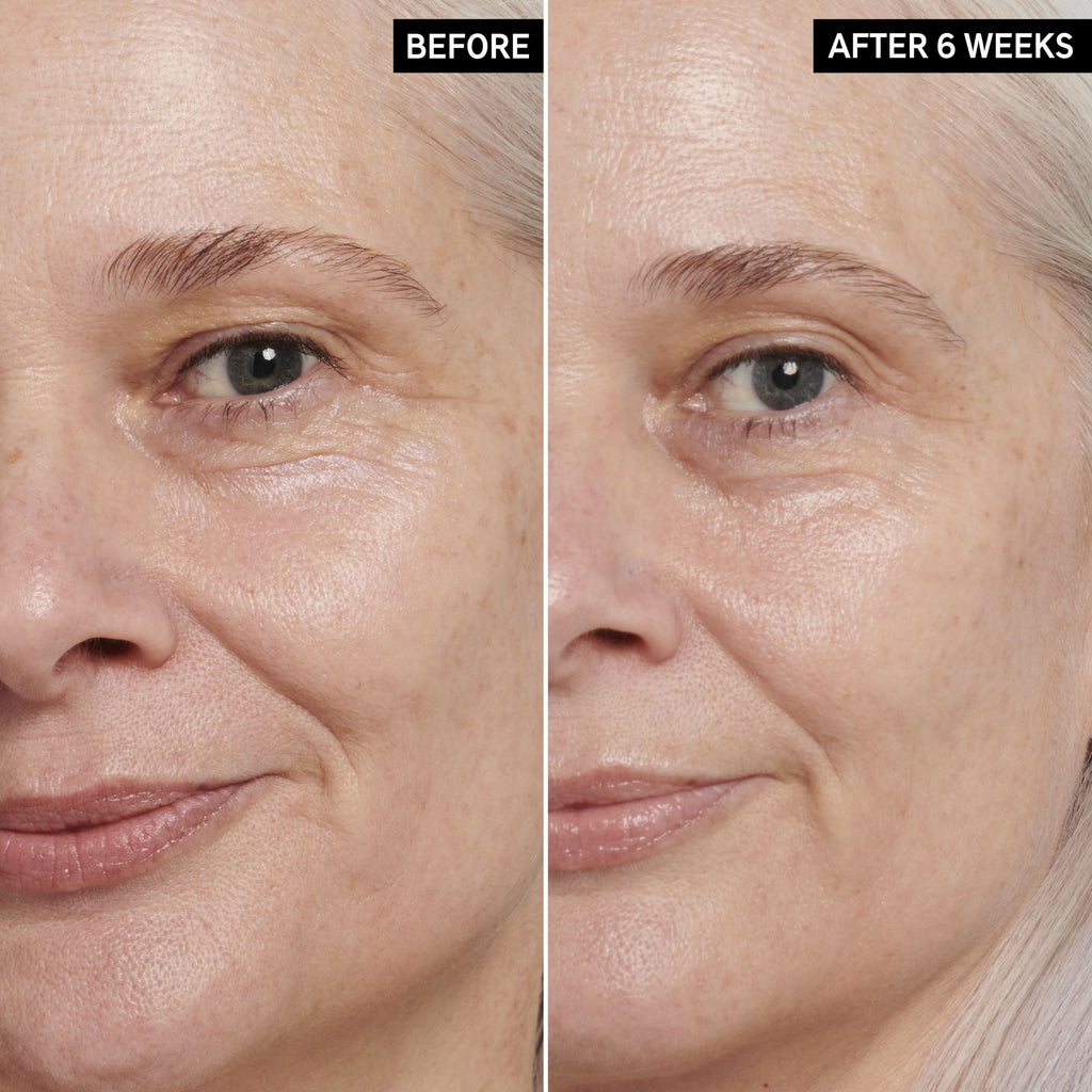 Retinol Eye Cream