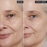 Retinol Eye Cream