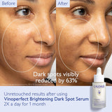 Vinoperfect Brightening Dark Spot Serum Vitamin C Alternative